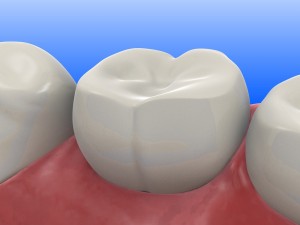 why-pocelain-fillings-are-safer-roseville-dentist