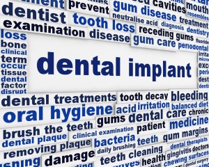 dental-implants-are-your-best-option-roseville-dentist
