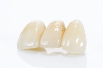 broken or chipped tooth sacramento