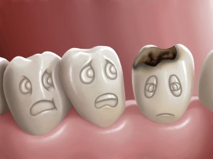 tooth-decay-will-not-get-better-unless-you-treat-it-roseville-ca-dentist