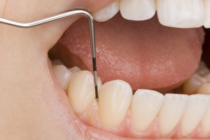 gum-disease-an-all-too-common-problem